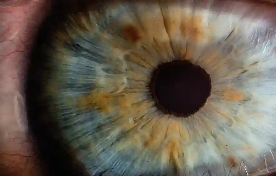 Eye closeup